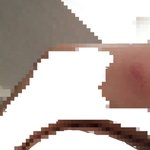 [댓글부탁해] (사진 있음) 나 맞은거 같아ㅜ?