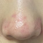 [조언부탁해] 나 피부 어떻게 해야돼?ㅠㅠㅠ