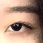 [19] 나 <b>쌍수</b> 성공함..?