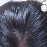 [댓글부탁해] 하 ㅅㅂ <b>이</b>정도면 탈<b>모임</b>?