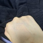 [드루와] 나 손 <b>흉터</b>좀봐..