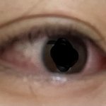 [댓글부탁해] 얘들아 나 <b>눈병</b>인가 ㅠㅠ?