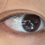 나 쌍커풀 <b>아웃</b>라인임 인라인임?