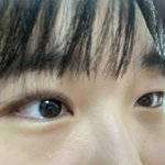 [드루와] 쌍수 전후 봐줄사람 ㅠ0ㅜ