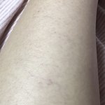 [댓글부탁해] 얘들아 나 뱀파이어인가봐
