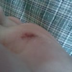 신종악성유해물질 대처법 6년정도 실험당함