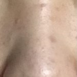 코 때문에 스트레스받아<b>뒤질</b>거ㅛ같아