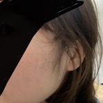 나 <b>옆</b><b>턱</b> ㅈㄴ ㅈ같음ㄹㅇ