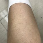 [댓글부탁해] 털 <b>이리</b> 나면 망한 거 아니냐