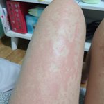 [이것좀봐줘] <b>병명</b>을 찾고 있어요 도와주세요