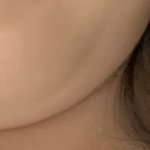 <b>턱살</b> 이정도면 ㅁㅌㅊ?