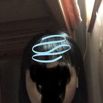 <b>안면</b> 비대칭 있음??