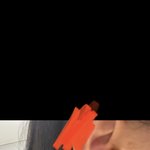 [댓글부탁해] 나 귀에서 <b>진물</b>나 어뜩해