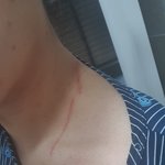 시어머니가ᆢ며느리폭행  저어찌해야될까요?