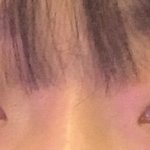 [댓글부탁해] 나 쌍수<b>전후</b> ㅇㄸ????