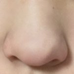 코 수술 하고 싶은데
