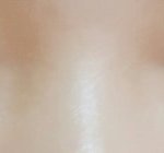 나 쌍수 개잘됨 보고 갈사람?~?