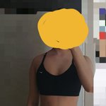 얘들아 승모근 어케 없애냐 ㅈㅂㅈㅂ 알려줘
