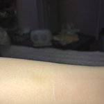 <b>파스</b>로 제모하기?!