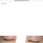 [드루와] 직장인 연차하루만 쓰고 <b>라섹</b>/쌍수한 후기