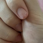 또 <b>손톱</b> 물어뜯엇어 레전드다,,