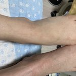 [댓글부탁해] <b>아파</b>보여?