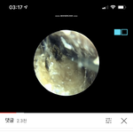 ㅅㅂ 유튜브 귀<b>청소</b> <b>영상</b>보는데 개웃김