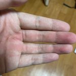 ㅅㅂ 얘들아 병이 안까져