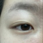 [댓글부탁해] <b>이런</b> <b>느낌</b>으로 쌍수 할 수 있을까??
