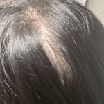 [댓글부탁해] 아 <b>시</b> 발 나 탈모 개심해지ㄴ<b>짜</b> 죽고싶다