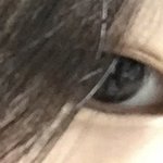 나 무조건 앞트임 해야되겠지..?