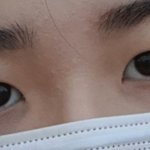 나 쌍수 한건데