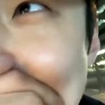 오세훈 볼<b>따구</b> 어쩔거임