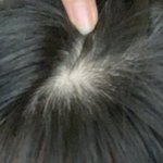 나 <b>탈모</b>맞지ㅅㅂㅅㅂㅅㅂㅅㅂㅆㅂㅅㅈㅂㅆㅂ