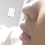 <b>치아</b>는 안 튀어나왔는데 입툭튀임
