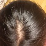 애들아 나 <b>탈모야</b>... ? ㅠㅠ