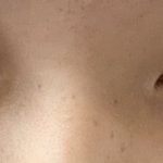 [댓글부탁해] 눈에 몽고<b>주름</b> 있는데 많이 별로야?