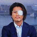 [뷰티] 짝남이 <b>안대</b>쓰면 어때?