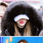 유아 입술필러 종결