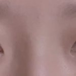 [댓글부탁해] 나 눈 수술 뭐뭐하는게 좋을까 ㅠㅠㅠㅠ