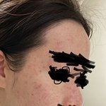 피부좋아지는법좀 알려주세요ㅠㅠ사진혐오주의
