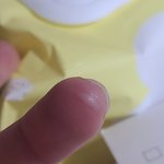 이거 <b>물집</b> 잡힌거야..?