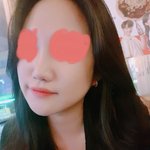 [꼭조언부탁] 코 성형 평가좀ㅠㅠ