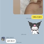 [19] ㅅㅂ <b>인도</b> 튀어나온곳으로 가다가 넘어짐