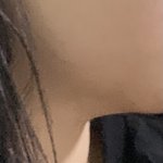 [19] 혐주의)나 살 찐 거 같애 아니면 <b>무턱</b> 같애??