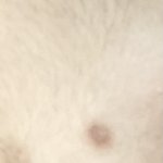 얘들아 ㅠㅠ 목 뒤 <b>흉터</b> 어케 없애 ㅠㅠ ?? 혐주의 사진 있어