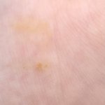 [ㅈㄱㄴ] ㅅㅂ 나 방금 <b>새똥</b>맞아ㅛ음