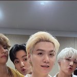 방탄 <b>슈</b>가 붓기 아직도 안 가라앉았냐?