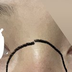 나만 코 <b>윗부분</b> 색 이렇냐..?