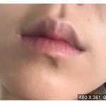 [드루와] 입술 <b>옹졸</b>한건 답 없냐